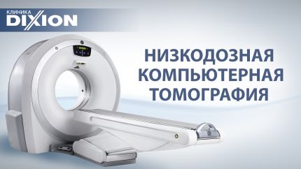 Низкодозная компьютерная томография в клинике DIXION